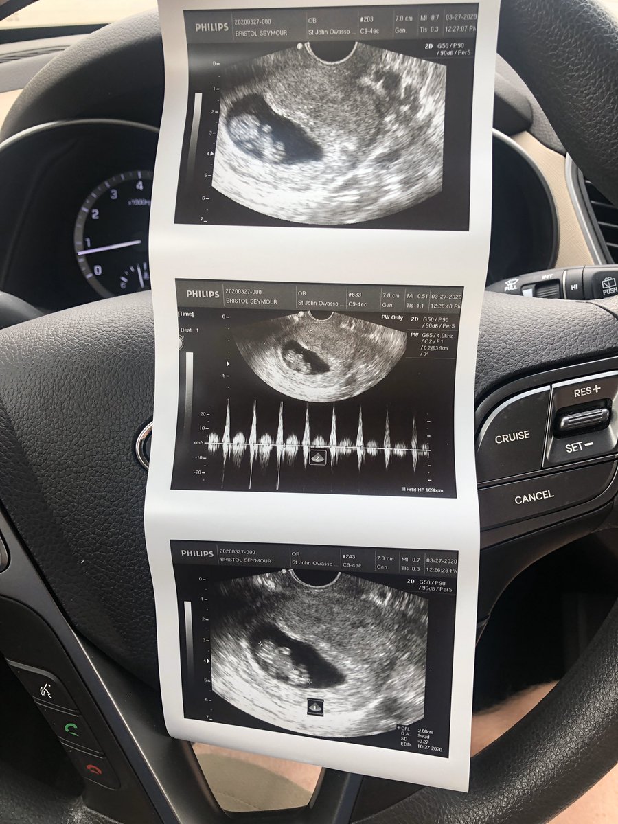 _Coach_Seymour's tweet photo. Baby #2 https://t.co/mOtFe8DHIB