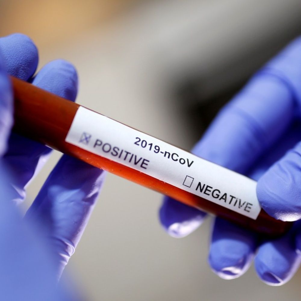diariodecuyoweb's tweet photo. Alertan por un nuevo posible síntoma de coronavirus - https://t.co/axaGdGRFed https://t.co/lCfLtqCgNu