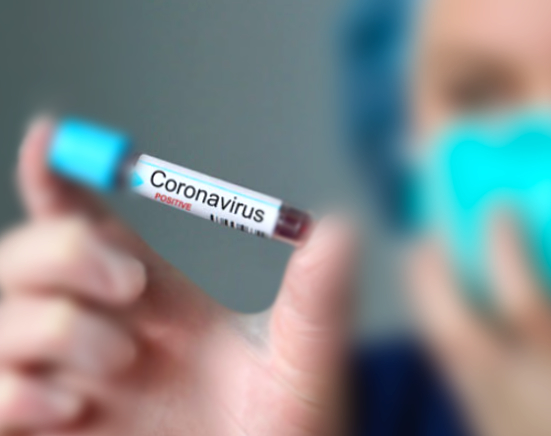 Plus411's tweet image. #coronavirus #COVID-19 ¿Cuándo se produce la propagación? Se cree que las personas son más contagiosas cuando presentan síntomas más fuertes (están más enfermas) Sin embargo podría ser posible que haya propagación antes que las personas presenten síntomas.