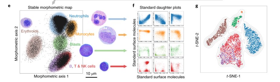 mmw_lmw's tweet photo. #2020_ReCapMarch | Multiplexed #SingleCell_Morphometry | Maps for hematopathology diagnostics | Sean Bendall @Stanford @NatureMedicine https://t.co/vR2lFDPNDx https://t.co/nmYkxTkeXP