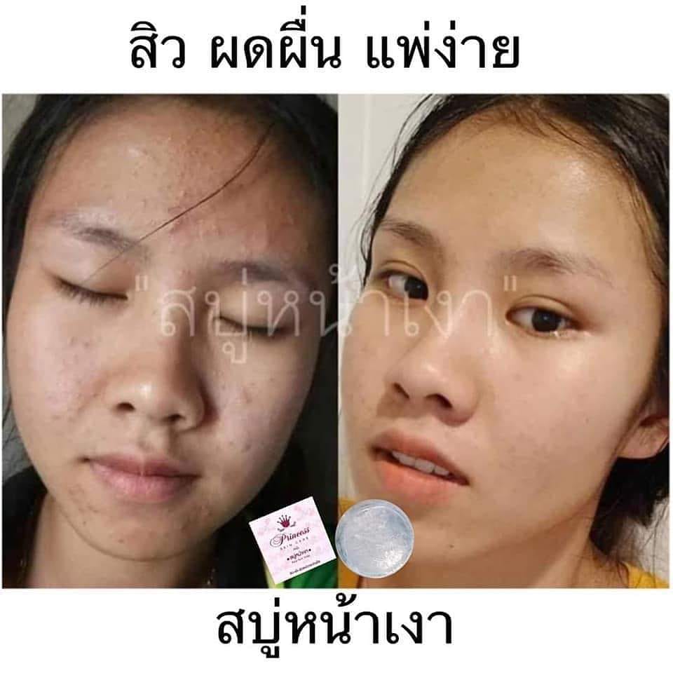 by_psc's tweet photo. เปลี่ยนไปขนาดนี้ไม่ใช้ได้ไงเนอะ https://t.co/zRlw5XbW2m
