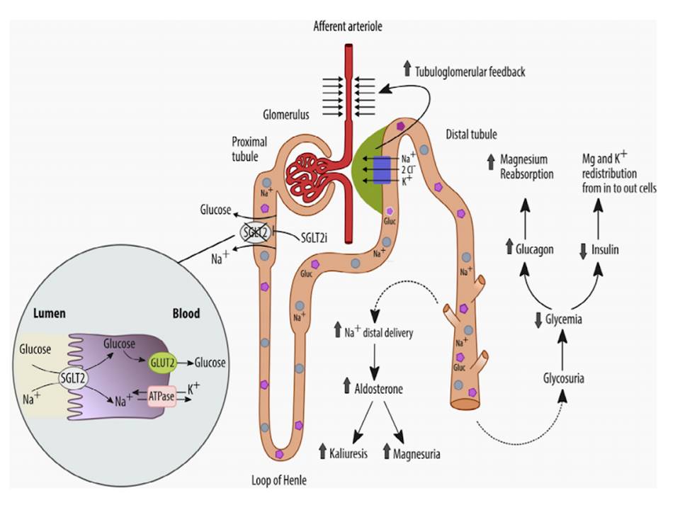 Before finishing, let's summarizeSGLT2 inhibition → Glycosuria, natriuresis, and osmotic diuresisSlight ↑ serum K and Mg levels ↑Pi → ↑FGF23→ ↓ 1,25(OH)2 D and ↑ PTH  https://asbmr.onlinelibrary.wiley.com/doi/pdf/10.1002/jbm4.10242