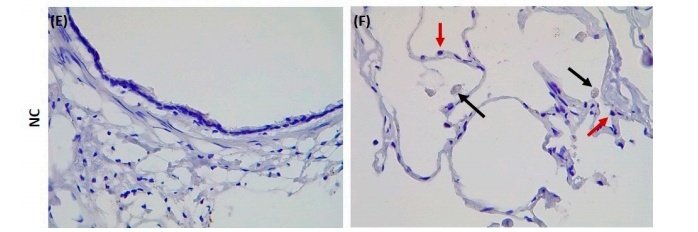 Gambar Normal Control, paru paru normal.Corak warna berbeda dengan gambar sebelumnya.Tidak terlihat jelas corak kuning (ACE2 terwarnai).Sel tetap memiliki reseptor ACE2 dan masih berpotensi terinfeksi SARS-CoV-2, namun jumlahnya lebih sedikit dibandingkan perokok.