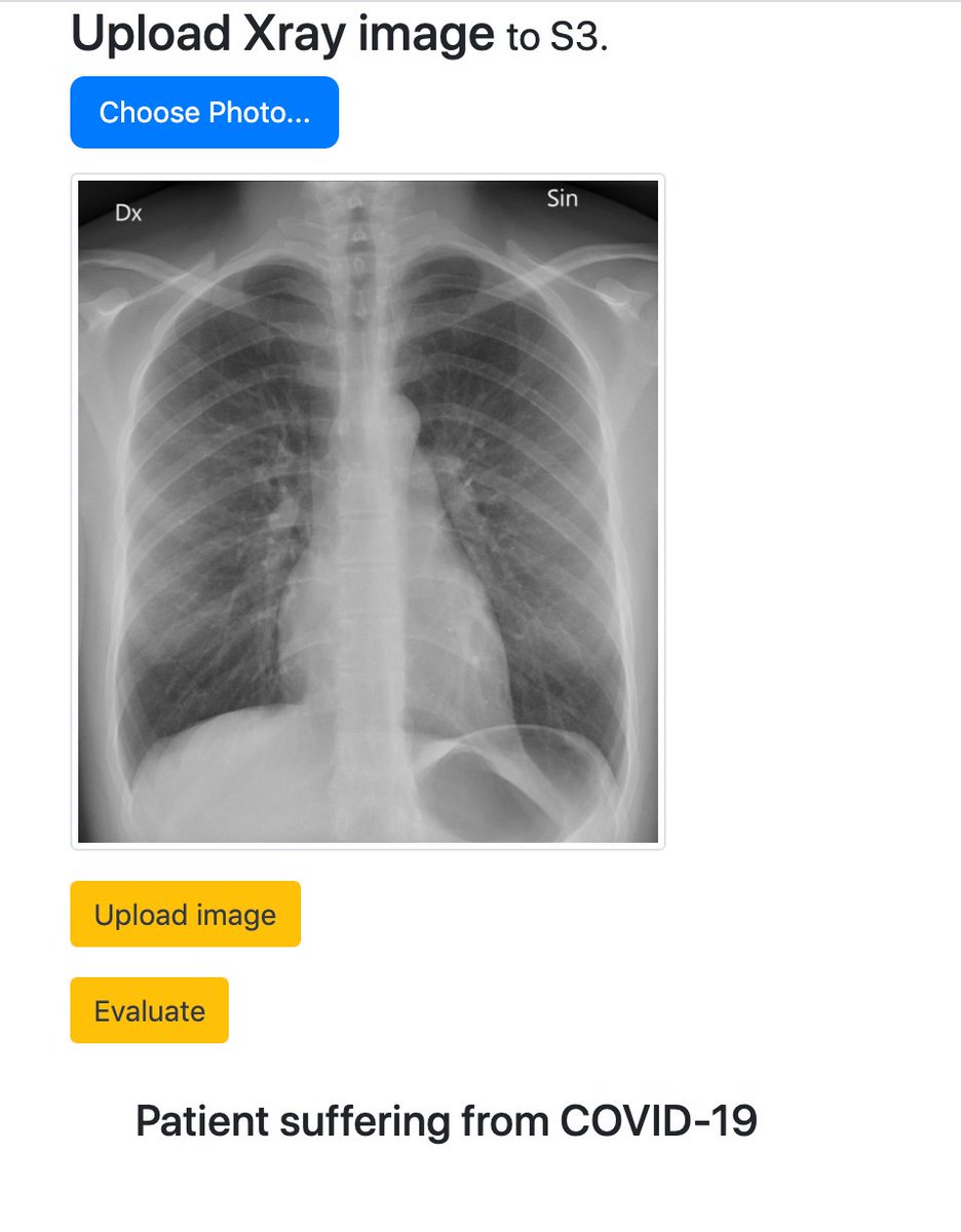 10/ XRay Karonaby  @justin34821724 and Ankit AroraThere is an urgent need for an alternate way to detect corona positive cases. XRay Karona aims to provide the alternate solution through an XRay scan of your chest. https://github.com/xray-carona 