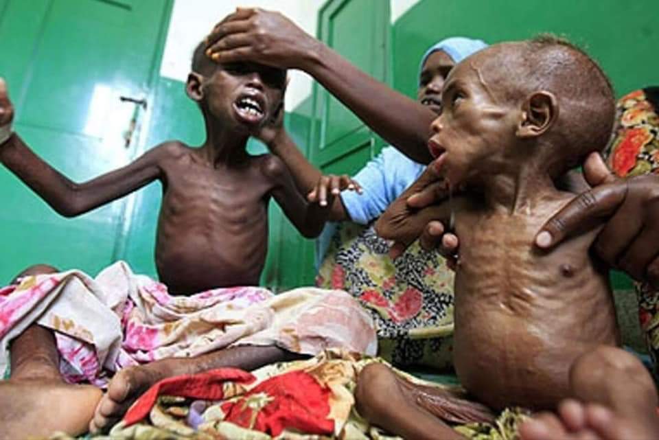 Korkmayın yemende afrikada onlar zaten ölüyordu şimdide her gün ölüyorlar bu çocuklar amerikalı,italyan,fransız,değil diyemi gündem olmuyorlar.