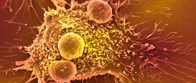 New AI-Powered Blood Test Promises Easy Screening For Over 50 Types of Cancer

sciencealert.com/ai-powered-blo…

<a href="/ScienceAlert/">ScienceAlert</a> #businessdevelopment #BBM #lifescience