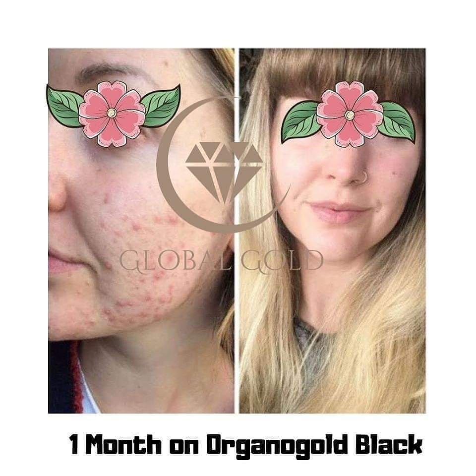 Peak_Infinity's tweet photo. 💐 These products are not only for weightloss, but excellent for skin problems too. Deliveries are happening during lockdown 💐
#healthyskin
#OGBlack
#1cupaday https://t.co/F9CyDmEXBp