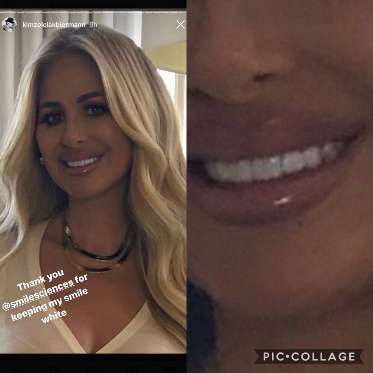 life_of_wig's tweet image. Hey smile sciences, did you know you cannot whiten veneers? And tell Kim that she forgot to photoshop the last tooth 💋💋💋💋 have fun scamming people 👍🏼 #scam #scamartist #ripoff #falseadvertising #smilesciences #kim #kimzolciak #kimzolciakbiermann