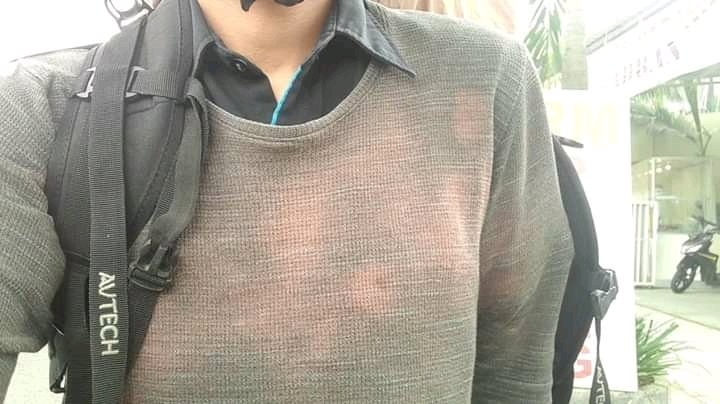 elninovena's tweet photo. Sekedar diketahui, desinfeksi adalah proses suci hama pada benda mati, menggunakan cairan desinfektan.
Untuk tubuh manusia namanya antisepsis menggunakan cairan antiseptik.

(2) korban desinfektan pemutih baju 
@blogdokter https://t.co/CPmdVKxciW