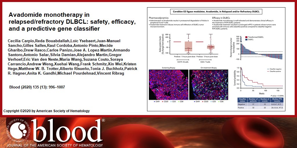 Avadomide monotherapy in relapsed/refractory DLBCL: safety, efficacy, and a predictive gene classifier ow.ly/rU2s50z2q6H