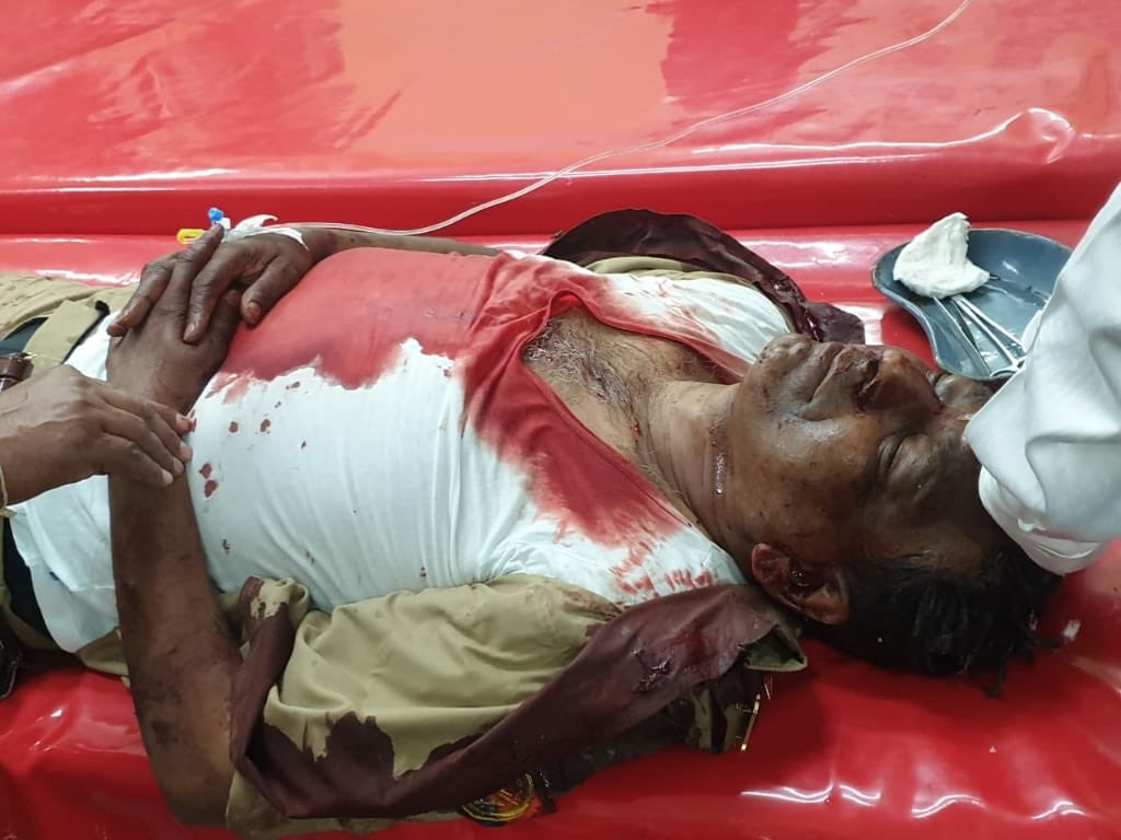 15n GRAPHIC WARNING: the cops beaten up in Muzaffarnagar today