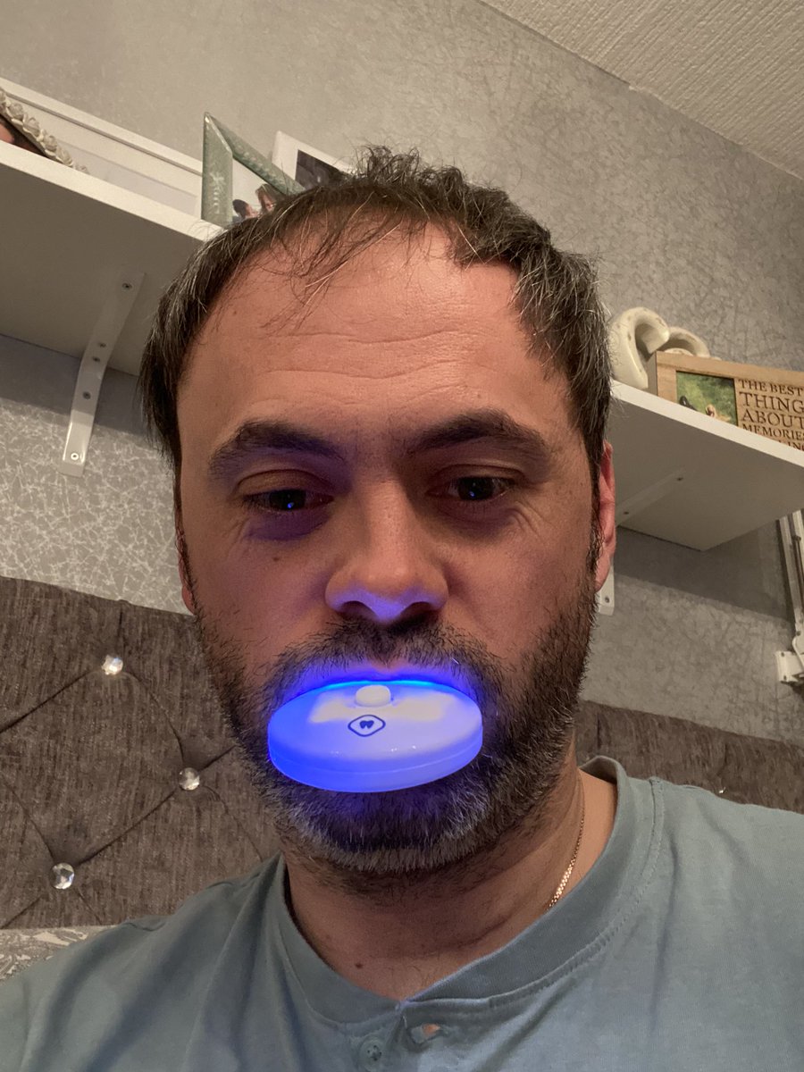 micky_nath's tweet photo. See if this really works... trying this out. Whiter teeth here I come. Lol look what this isolation has brought me too. 🙈 #drdent #teethwhitening https://t.co/azqt4Ovmdz