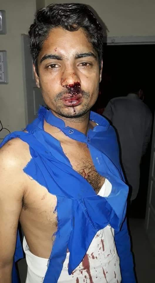 My team has been attacked while distributing ration to daily wage earners in Shahdadkotl Sindh, Pakistan by the goons of the local MPA  @M_NMagsi ! Typical feudal thinking!  #COVID19Pandemic  @mehdirhasan  @ImranKhanPTI  @MuradAliShahPPP  @MediaCellPPP  @Amierasawas