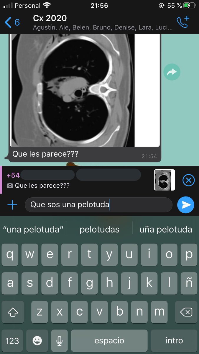 guidomart1n's tweet photo. Otra vez mi compañera de mierda chupándole el orto AL JEFE DE LA CURSADA MANDANDO IMÁGENES DE TOMOGRAFÍAS COMO SI ESTUVIESE ESTUDIANDO. 1 fav y lo mando https://t.co/msevxwQ2eT