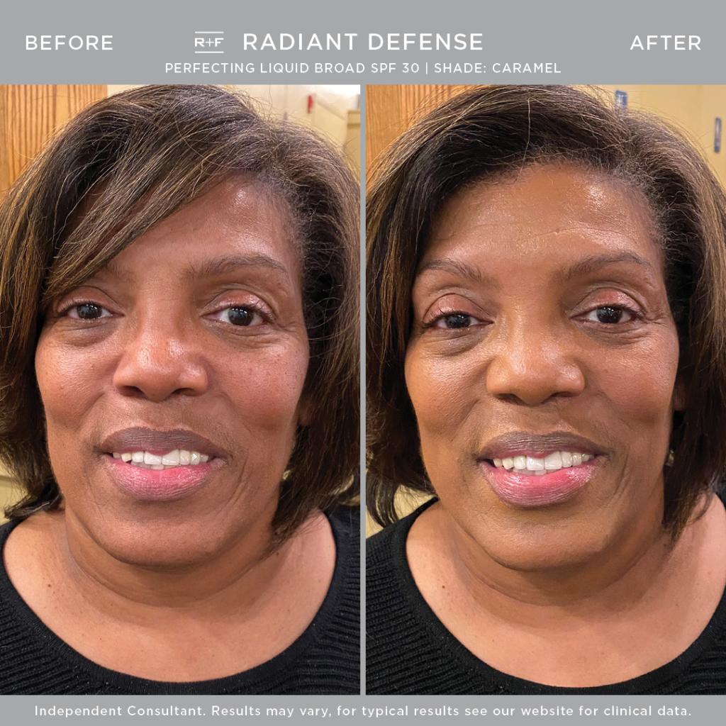 RodanFieldsHQ's tweet photo. Ready to break up with makeup for smoother, more even, healthier-looking skin? You need just 1 week to see results. Check out Before + Afters in shades Truffle, Caramel, Cream, and Honey. We’re so sure you’ll ❤️it, we offer a 60-Day Money-Back Guarantee. https://t.co/lNYfDJEBPV https://t.co/17LGXU2x86
