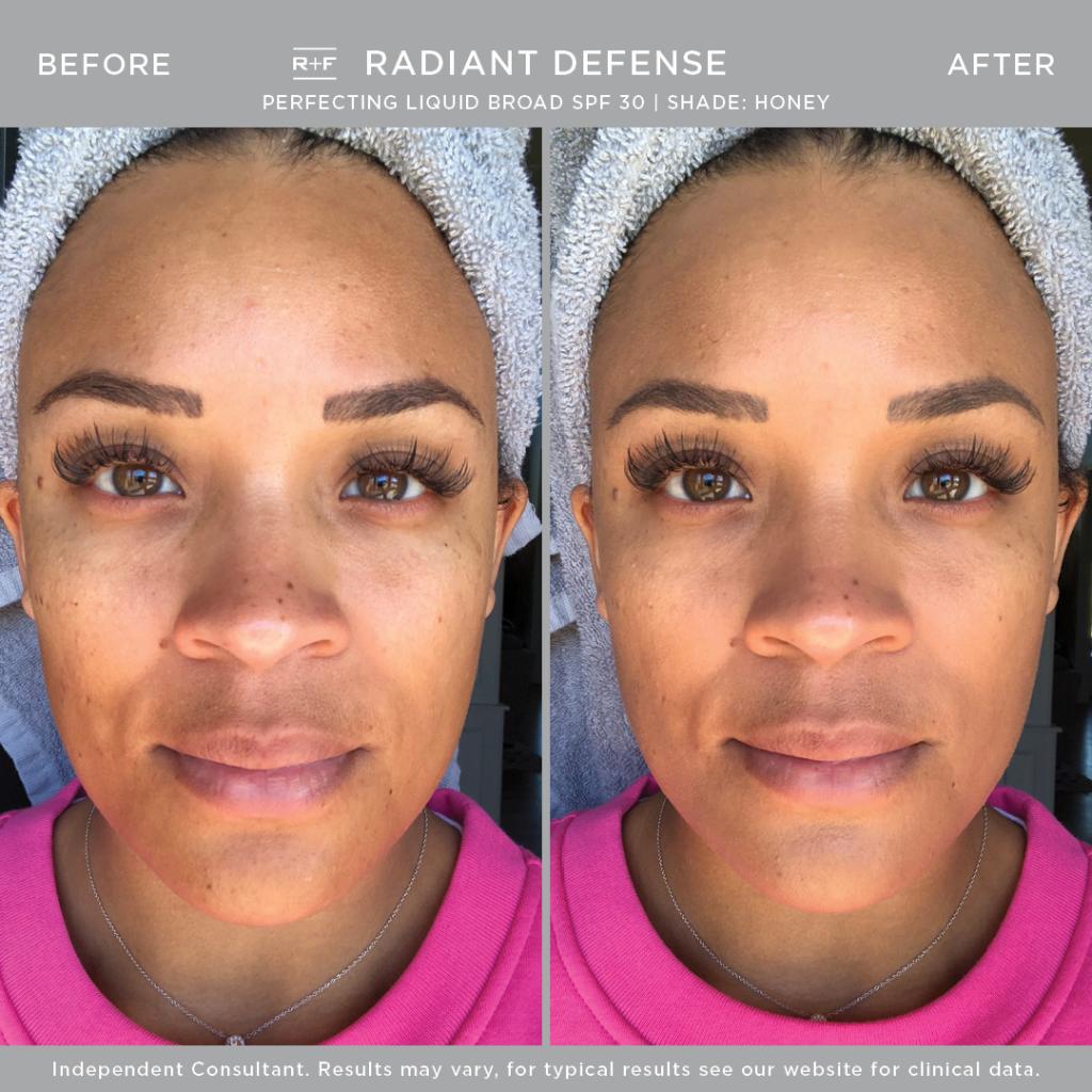 RodanFieldsHQ's tweet photo. Ready to break up with makeup for smoother, more even, healthier-looking skin? You need just 1 week to see results. Check out Before + Afters in shades Truffle, Caramel, Cream, and Honey. We’re so sure you’ll ❤️it, we offer a 60-Day Money-Back Guarantee. https://t.co/lNYfDJEBPV https://t.co/17LGXU2x86