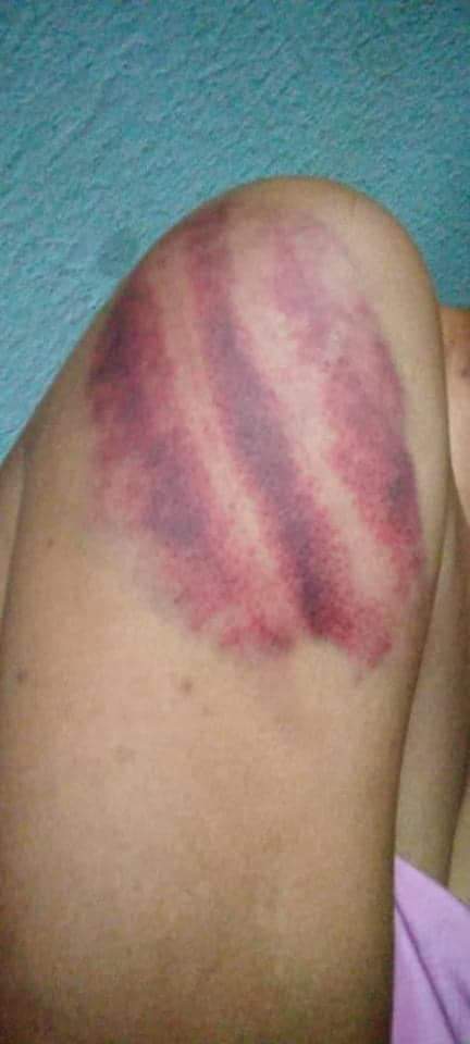 confluenceviews's tweet image. Face of a RAPIST.
Pictured is #Kogi state’s commissioner for water resources, Mr. Abdulmumin Danga.
He stripped Elizabeth naked, beat her up &amp;amp; made a nude video of her then RAPED her.
Liz found the courage to admit rape at the hospital today @PoliceNG @FanwoKings @ed_onoja