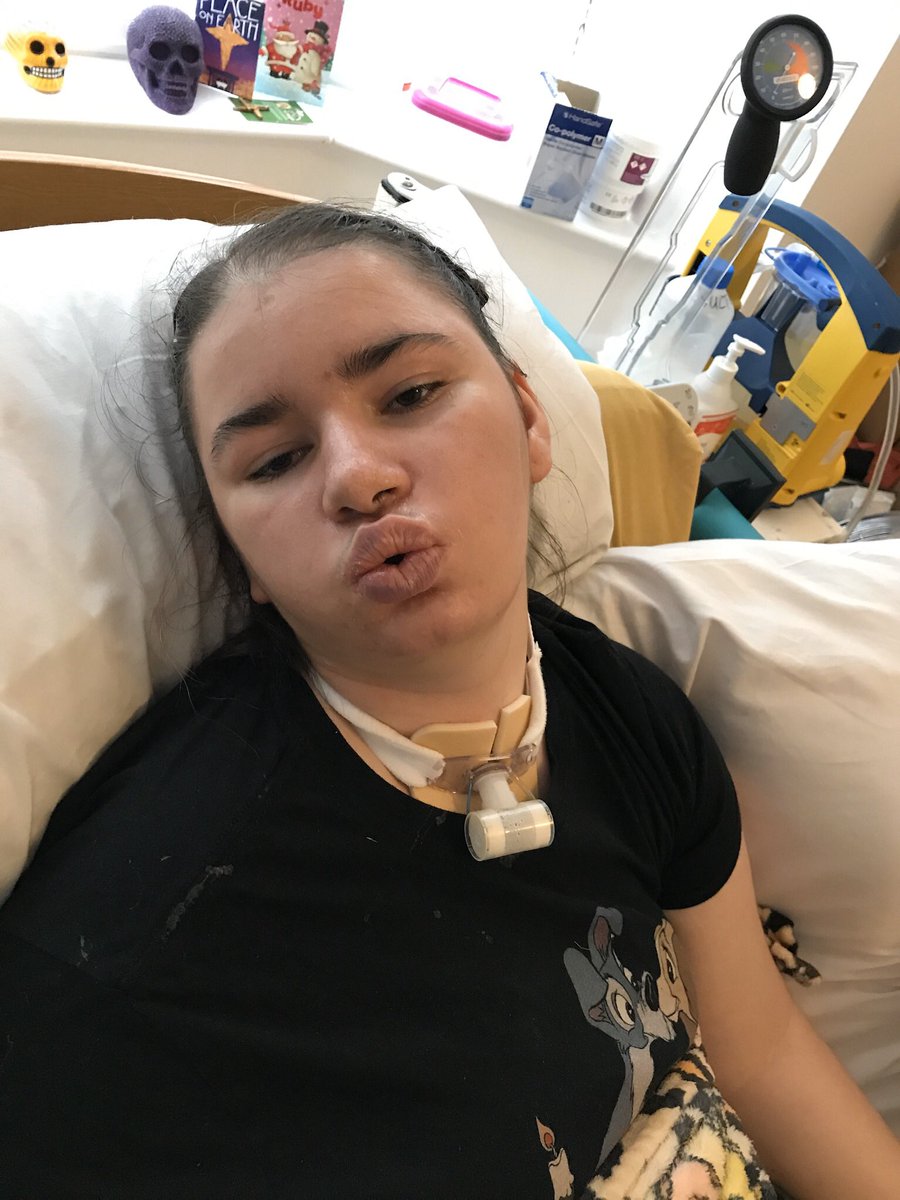 WooClements's tweet image. Our beautiful ruby was sadly diagnosed positive for Covid19 yesterday been in hospital 3 weeks &amp;amp; caught it at the hospital please pray for ruby 🙏💜 stay at home &amp;amp; keep safe #COVIDー19