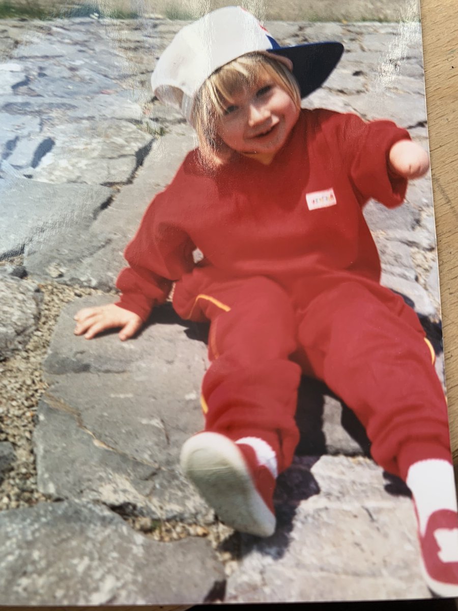 Happy limb difference awareness month from a true 90s (actually this is probably late 80s) mini me! #limbdifference #nemo #LimbLossAwarenessMonth #limbdifferenceawarenessmonth @ReachCharity @openbionics @luckyfinproject