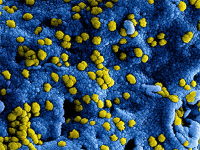 Kadaster_Int's tweet photo. The impact of the #COVID19 virus on all parts of the world is unprecedented. We know that each and every one of you is working hard to stay healthy, keep things going and help each other. For @kadaster_int the situation has changed drastically as well 
https://t.co/tnEBYlQ4FY https://t.co/1mxQqHRx4F