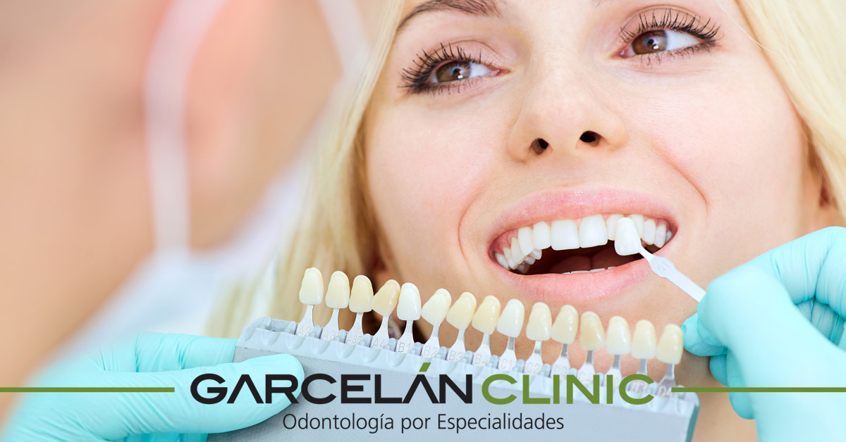GarcelanClinic's tweet photo. Las carillas de porcelana permiten cambiar forma, tamaño y color de tus dientes. Se trata de un tratamiento de #EstéticaDental que ofrece muy buenos resultados. Te contamos cómo va: https://t.co/FnFDnv2wBG https://t.co/5LWMR9n3BW