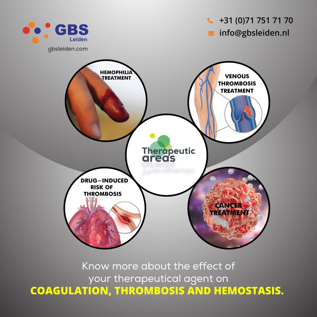 Our services warrant that your concerns about the unknown effects of your therapy on hemostasis, coagulation and thrombosis are addressed by our top-notch experts implementing assays that are specially adapted to the specifics of your project. gbsleiden.com/hemostasis/