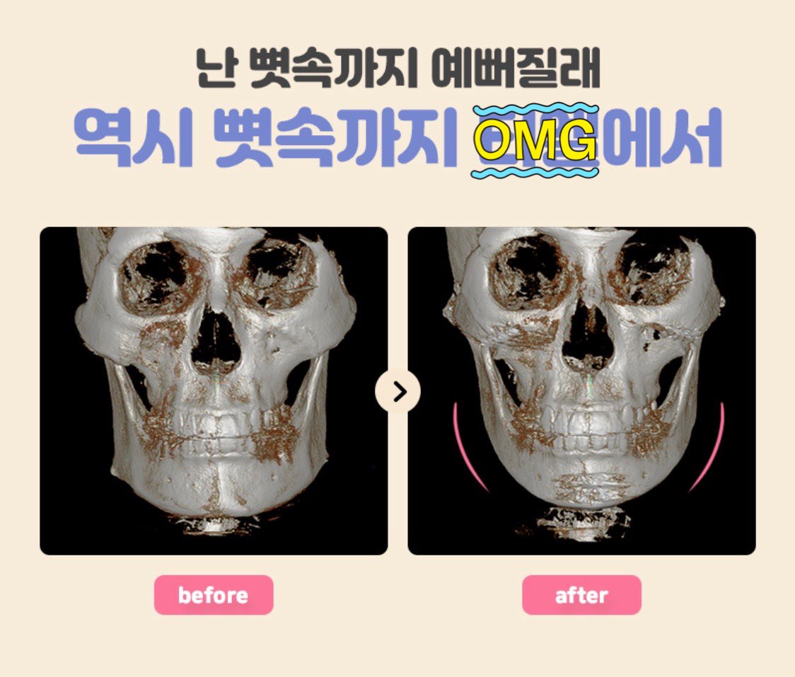 미친,,,
저런 걸 보고 미적 욕구를 자극받는 여자는 별로 없을텐데 여자를 무슨 "예쁨"이라는 말에 무릎반사로 반응하는 저능아로 보고 잇음