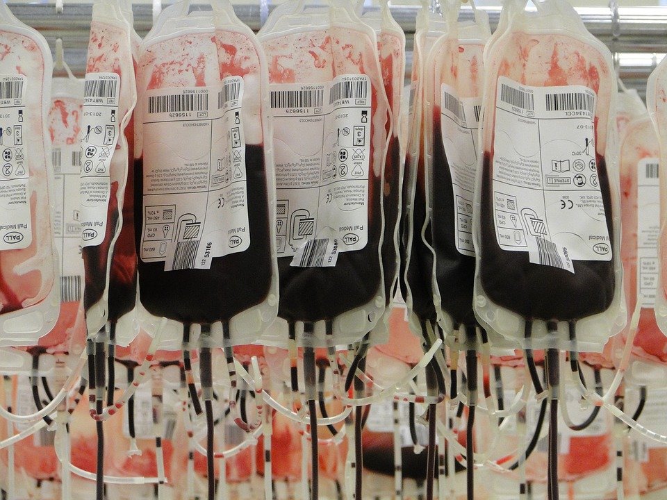 Macam mana saintis kita dulu terfikir pasal pengkelasan darah A, B, AB dan O? Kenapa ada sesetengah darah tak boleh bercampur dengan darah lain? Korang tak tahu korang darah apa, tapi teringin nak tahu korang darah apa?Teruskan baca untaian ini. Sejarah pengkelasan darah.