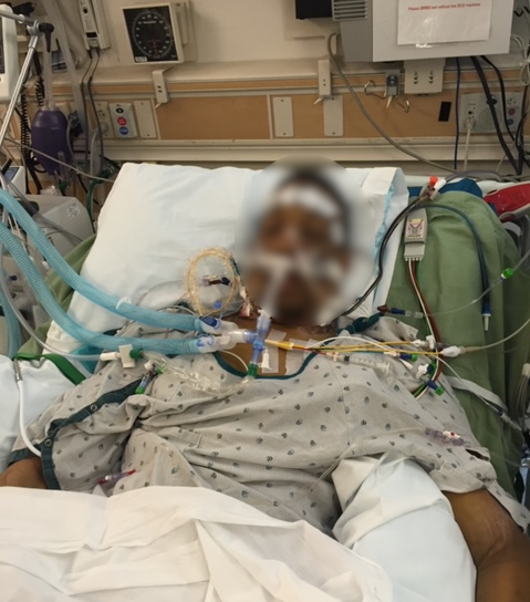 SheillaDingus's tweet photo. #NFL-#NFLPA Disability Plan didn't find this man to be disabled. It was only through a Social Security Administration determination that he was approved for NFL benefits. The new CBA wants to take this away.
@E_Reid35 @RSherman_25 @onemangang97 @meiselasb @GencoLaw @ChuckModi1 https://t.co/hfH8nBxbEC