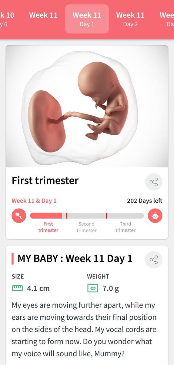 AlejandroEdmark's tweet photo. Our little angel from above is now on week 11. Can't wait to see you  on april 15 hope you did well and stay healthy. We love you so much our little angel ❤️

PS:Medyo tampo rin ako konti kasi pati ba naman sa app si mommy @MariaKylaa ang kausap mo pero okay lang love you 😘 https://t.co/VtJ23etNPe