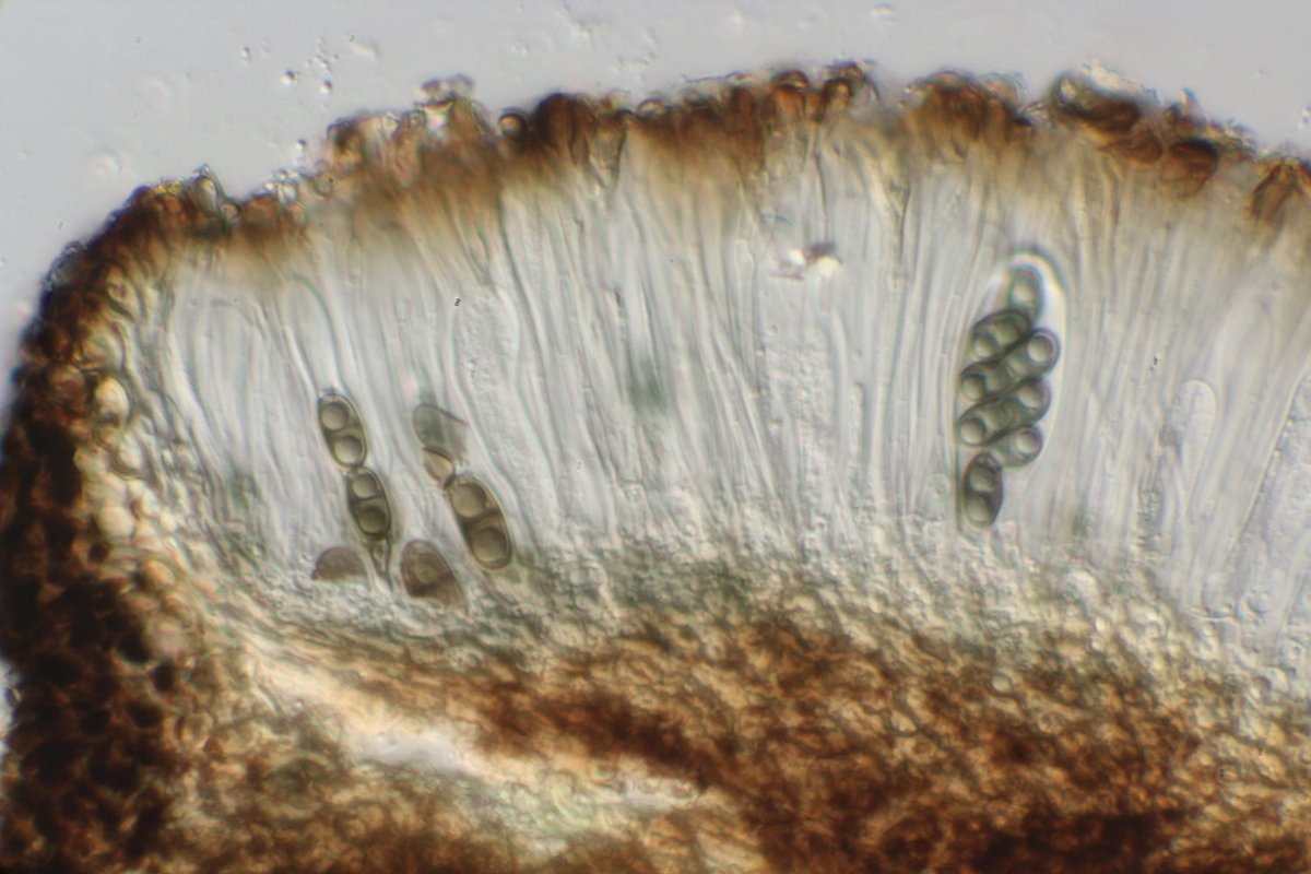 Here is an apothecial section of Amandinea punctata. The paraphyses and exciple have brown, swollen apices. These are similar to the hyphae in the pycnidium at the start of this thread.