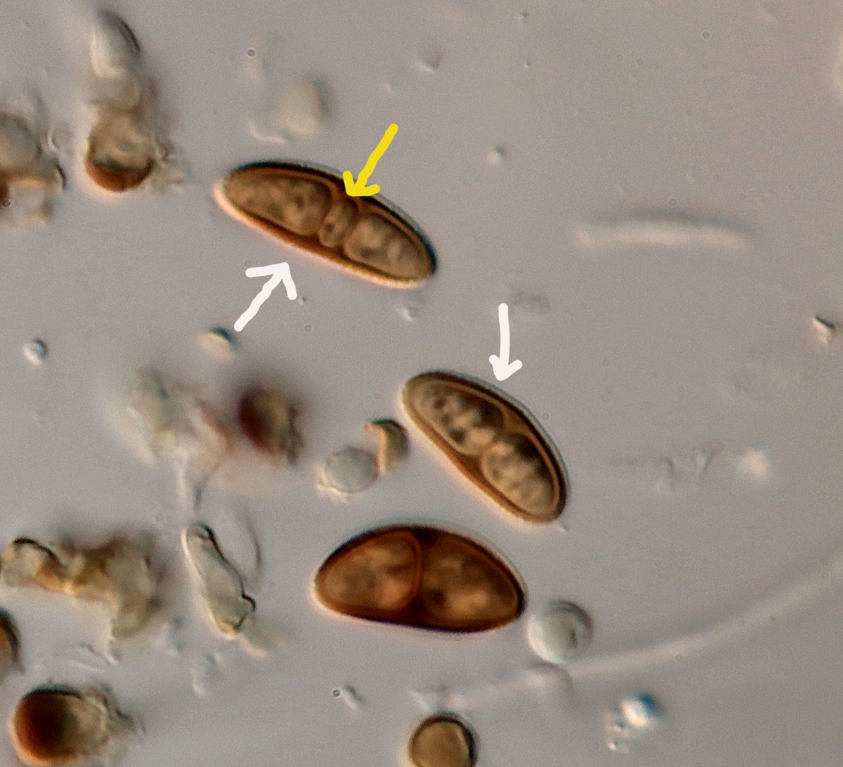 The query went on. The 'Flora' states that spores of A. punct. are smooth. White arrows indicate slight ornamentation? Yellow arrow - 'third cell'? or aberrant septum? Time to get microscope and specimens out.