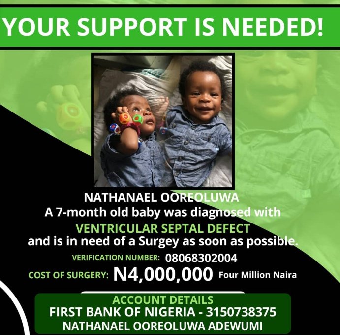 koolkay005's tweet image. Please, use your kind heart to save this little Boy. #saveNat #pray4Nat