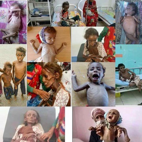 Melika88654972's tweet image. Open your eyes to the onset of sixth years of war in Yemen. Around 25 million women and children in Yemen are in need of the world's humanitarian aid. Break your silence, say something and help the innocent children &amp;amp; women.
#EnoughWar 
#ThePromisedSaviour