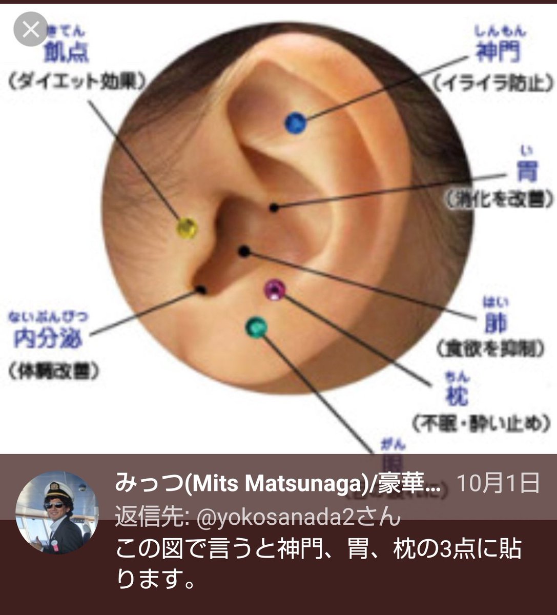 えみすけ 2年前 みっつさん Mits Acu がツイートされてた 吐き気に対しての耳ツボ つわりで苦しんでる妊婦さんにもすっごく効いた 妊娠初期で吐き気や気持ち悪さに悩む方は是非是非試してみてほしい