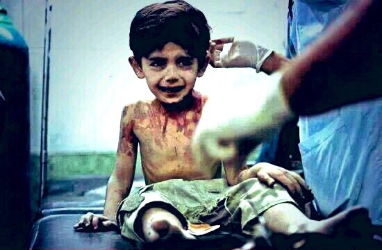 🔸️Hatırladınız mı bu Suriyeli çocuğu? Daha 3 yaşındaydı. Ölmeden önce dedi ki: "Sizi Allaha şikayet edeceğim, Her Şeyi O’na Anlatacağım"
▫️Dünya yanıyor aheste aheste, 
Hemde çocukları öldürmeyen bir virüsle.