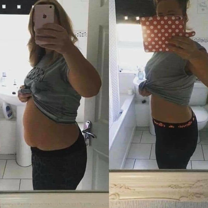 OyekanmiMrs's tweet photo. Kellies Results are so amazing I just had to share them tonight
Managed this amazing outcome in just 3 weeks
Using our Ultimate Babe Package
#healthyliving
#healthylifestyle #ultimatebabe
#amazing #loveyoursoul #askmehow #shakes #boosters #berries #weightloss #smashedit #love https://t.co/8bdXuHWj5z