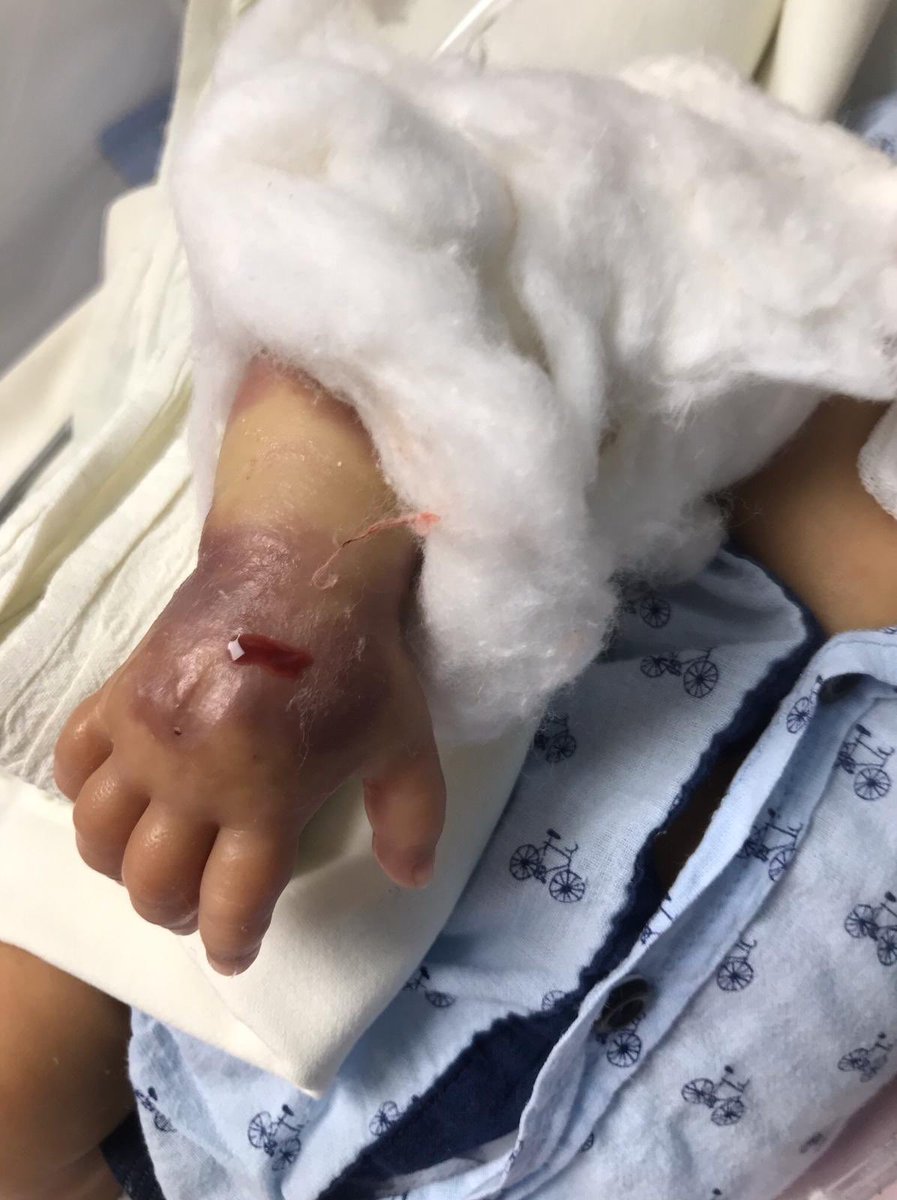 Bebeğime ne yaptınız? Suçluların cezalandırılmasını istiyorum! Hesap versin bunun sorumluları!! <a href="/drfahrettinkoca/">Dr. Fahrettin Koca</a> <a href="/abdulhamitgul/">Abdulhamit Gül</a> <a href="/RTErdogan/">Recep Tayyip Erdoğan</a> <a href="/Akparti/">AK Parti</a> <a href="/ziyaselcuk/">Ziya Selçuk</a>