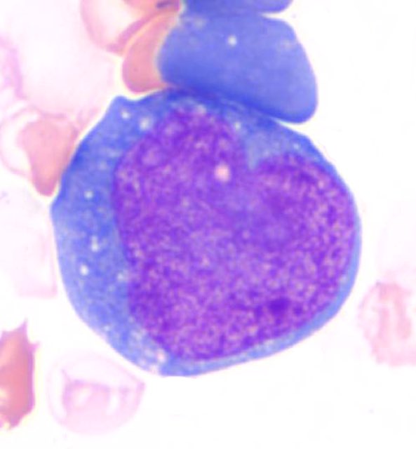@MCWPathology (@mcwpathology) on Twitter photo <a href="/mcwpathology/">@MCWPathology</a> sending 💜 and support to our <a href="/MedicalCollege/">Medical College of Wisconsin</a> <a href="/Froedtert/">Froedtert</a> <a href="/childrenswi/">Children's Wisconsin 🏥</a> healthcare workers 🏥
#coronavirus
#MCWArtClub <a href="/mcwpathology/">@MCWPathology</a> sending 💜 and support to our <a href="/MedicalCollege/">Medical College of Wisconsin</a> <a href="/Froedtert/">Froedtert</a> <a href="/childrenswi/">Children's Wisconsin 🏥</a> healthcare workers 🏥
#coronavirus
#MCWArtClub