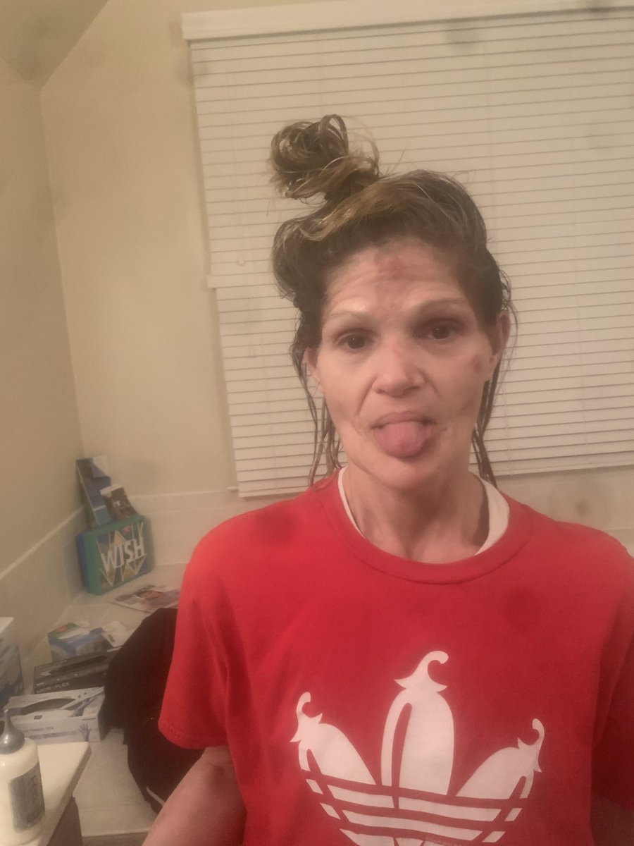 Bellamarie777's tweet photo. @tanamongeau Tana this is my mom who is sick with cancer . I can no longer afford her perscriptions and she’s running low ! We are running low on groceries as well ! ANYTHING HELPS . $babycashb I’m so sorry and this is so embarrassing https://t.co/vbT1NxJKhR