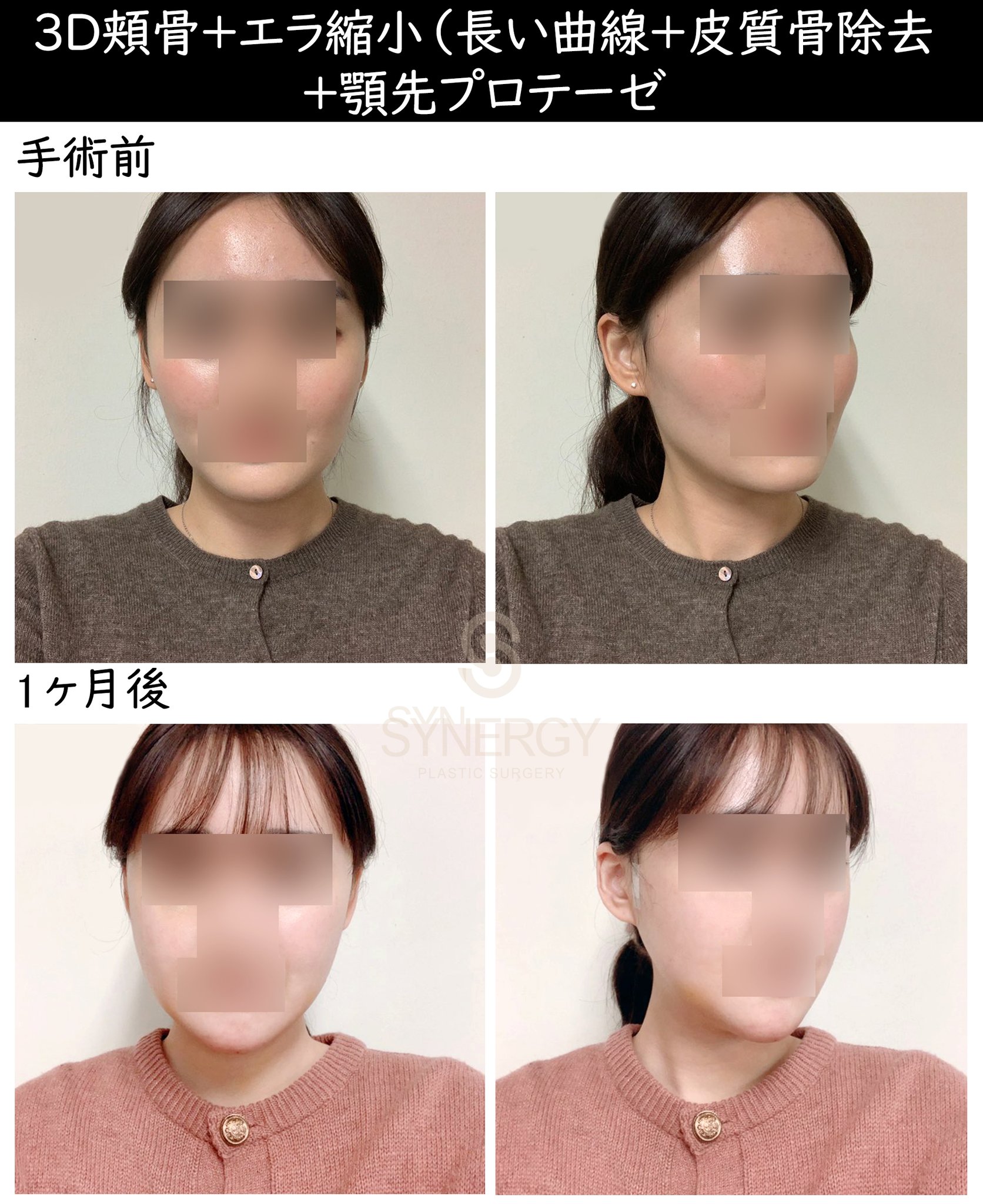 頬骨 エラ 髪型 頬骨 エラ 髪型