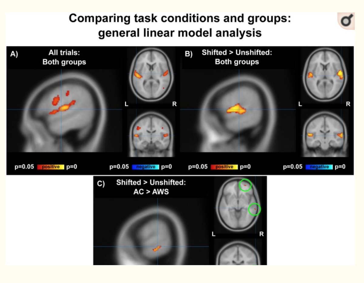 (11/11) ...its low sample size, and the study’s inability to replicate behavioral results from previous studies . To read more, please see:  https://www.ncbi.nlm.nih.gov/pmc/articles/PMC7053555/ #FluencyFriday  #stuttering  #science  #neuroscience  #attention  #stammering