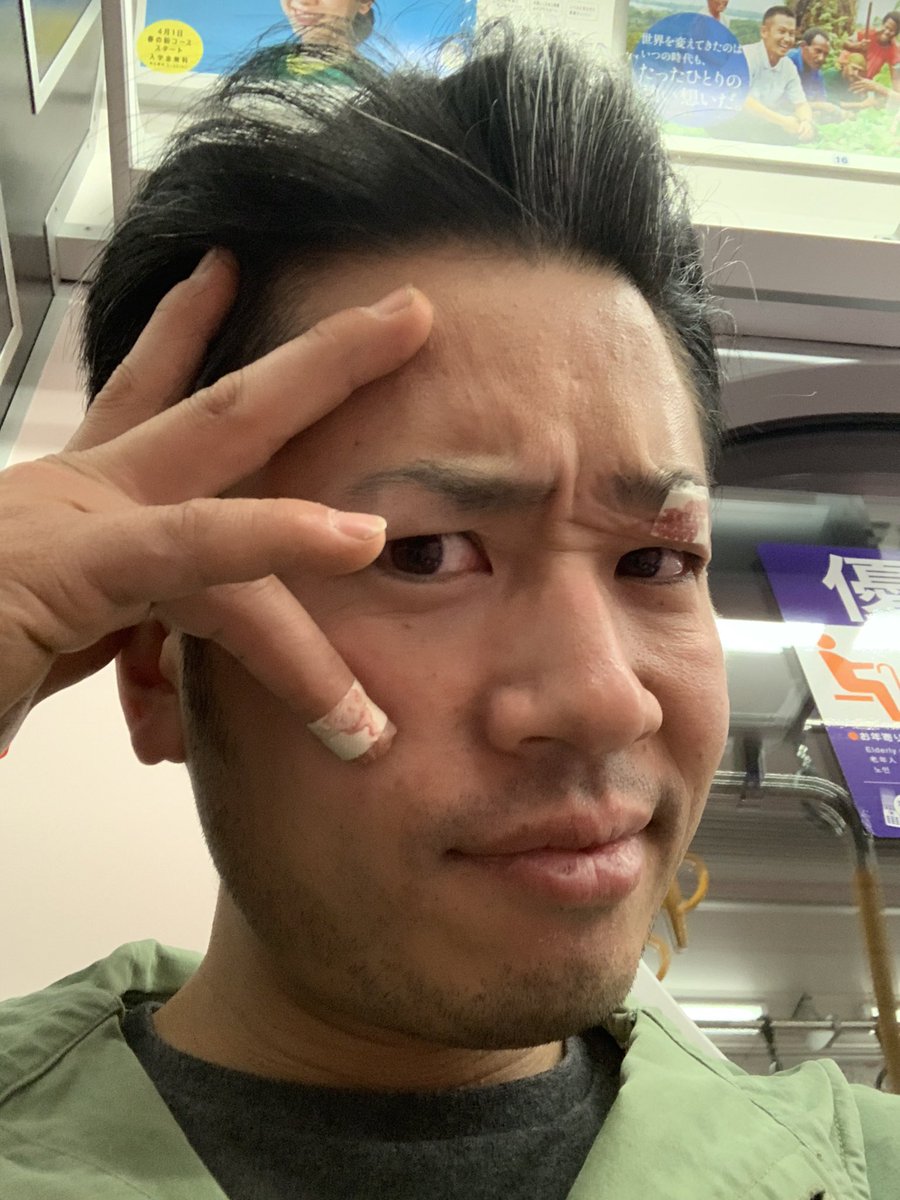 Nobu_Fractures's tweet photo. みんな元気がいいよね https://t.co/UVYKWtdUwo