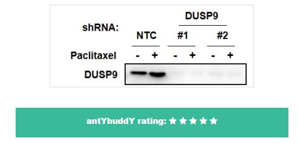 antybuddy's tweet image. New MaxBuddY antibody review hot of the press. The reviewer validated Dusp9 antibody from Novus for WB using a Knock Down stratergy: lnkd.in/dsqESH8

#independentvalidation #cancerresearch #oncology #openaccess #antibodies #westernblot #scicomm