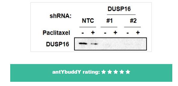 antybuddy's tweet image. New MaxBuddY antibody review hot of the press. The reviewer validated anti-Dusp16 antibody from Novus for WB using a Knock Down stratergy.

lnkd.in/dfhmzsZ

#antibody #lifescience #independentvalidation #oncology #cancerresearch #scicomm #westernblot