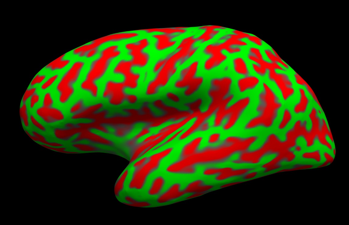 2b - Learn  @FreeSurferMRI . A suite of tools to analyse cortical surfaces. Ever wondered how people make those nice inflated brains with blobs, well is freesurfer. Surface plots are cooler, and more easy to visualize than volume plots