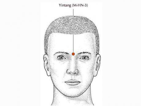 AcupunctureAmanda tweet media