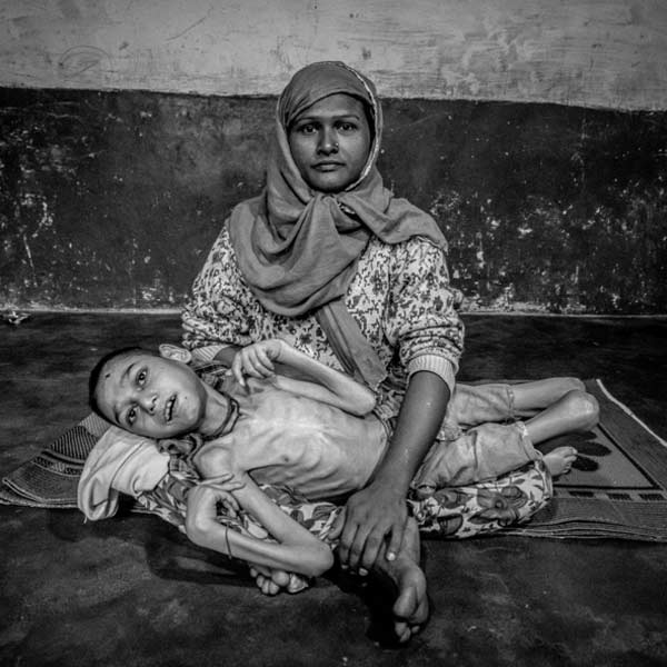 Hoy dia, mas de 36 años despues, decenas y decenas de miles de personas siguen siendo envenenadas hoy dia en Bhopal. Las mujeres en los barrios de alrededor del desastre alcanzan la menopausia a los 30. Los niños nacen con deformidades y las niñas no menstrúan hasta los 18.