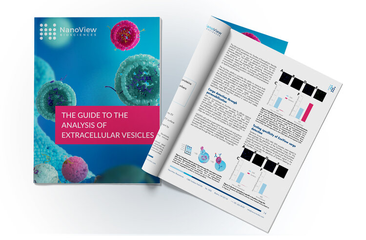 Interested in EVs and would like some pandemic reading!? Then download our latest eBook. It covers EV sizing, counting, phenotyping, cargo measurement, and purification-free EV measurements
nanoviewbio.com/download-ebook

#exosome #exosomes #extracellularvesicles #microvesicles