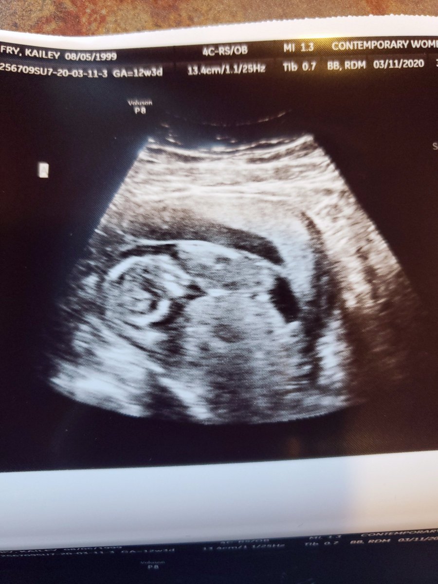 classyricegrain's tweet photo. @JeffreeStar

$brxanne ( cashapp ) Soon to be mommy of twins! I have an online shop but currently unable to ship anything so I canceled all orders. ♡ any help is appreciated! Stay safe!
#JeffreeStarApproved ♡ https://t.co/PkWPE2URPn